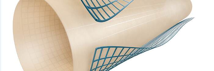 FLEX 설계: 얇은 벽과 스크래칭된 슬리브용